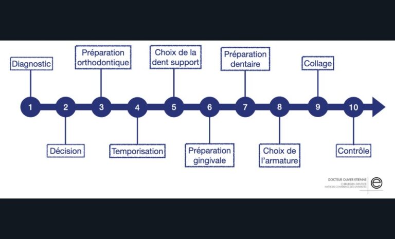 2. Étapes de réalisation d’un bridge cantilever antérieur.