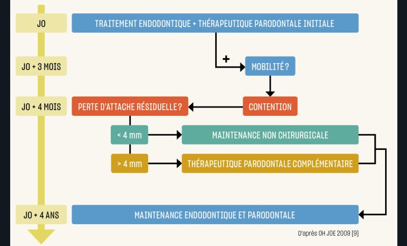 11. Prise en charge combinée d’une LEP. Arbre décisionnel pour prise en charge thérapeutique de lésions endo-parodontales (a).