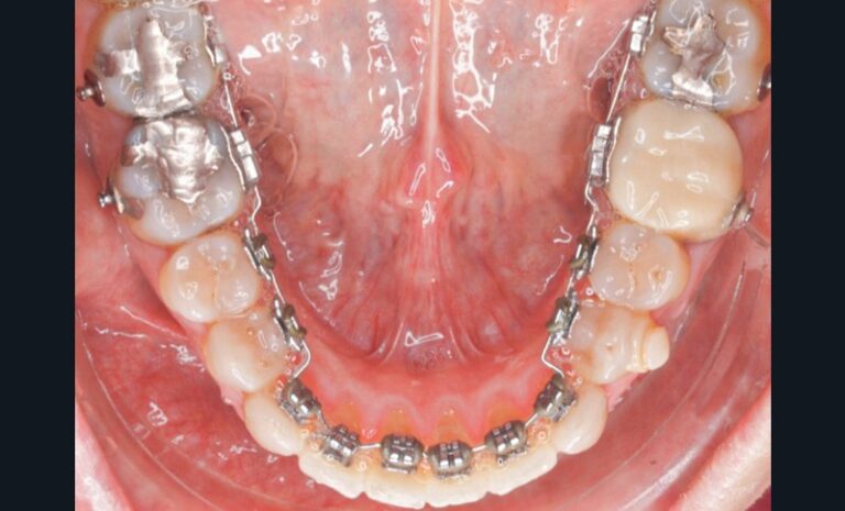 Figure_3_-_situation_clinique_pré-chirurgicale3-tt-width-800-height-484-fill-1-cr