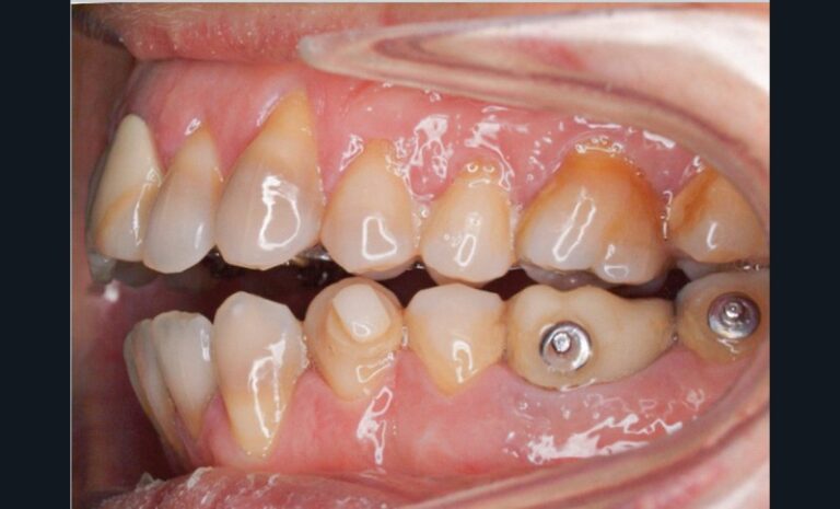 Figure_3_-_situation_clinique_pré-chirurgicale4-tt-width-800-height-484-fill-1-cr