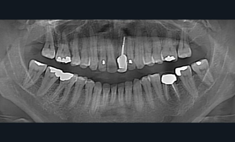 Figure_5_-Panoramique_-_Fin_de_traitement-tt-width-800-height-484-fill-1-crop-0-bg